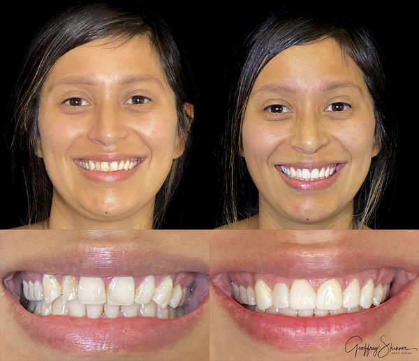 New Amazing Smile