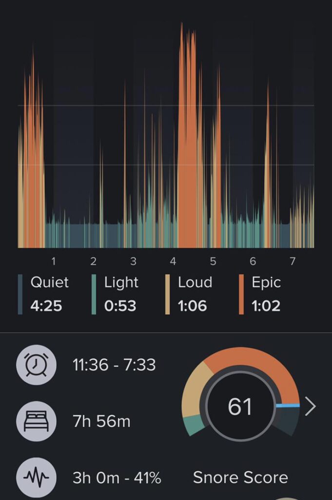 Night Lase Non-Surgical Laser Sleep Apnea Treatment