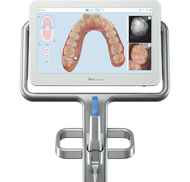 Itero Laser scanner at Hillsboro Dental Excellence