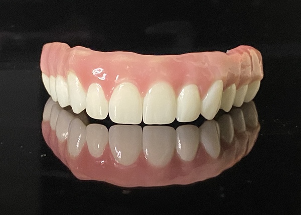 All on 4 Implant Denture