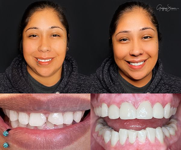 Our Patient's Happy Smile