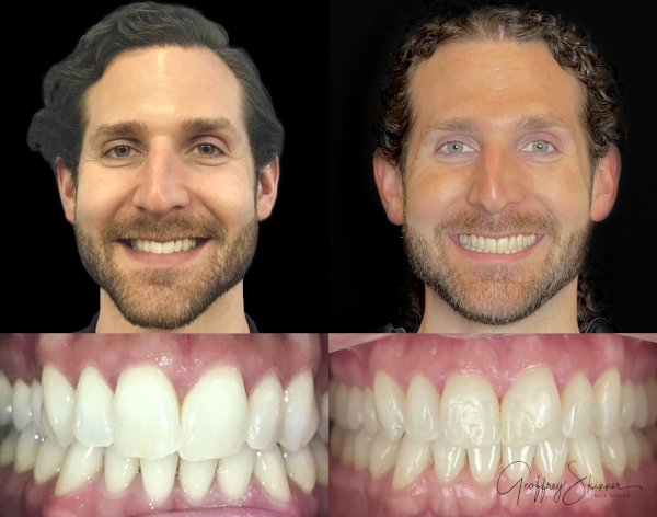 Tobias has fantastic new World-class Smile