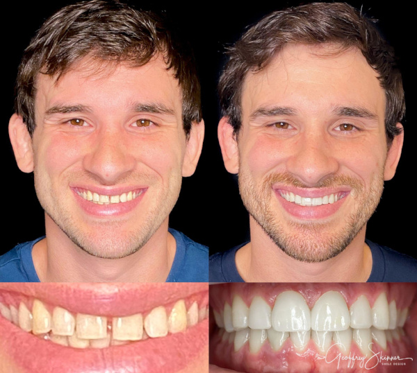 Cosmetic Dentistry