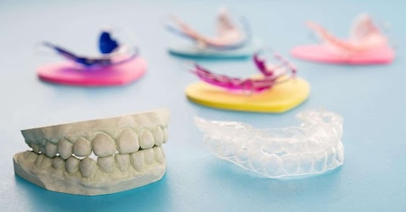 Plastic models of various Mail Order aligners.