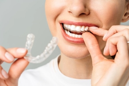 A woman wearing Invisalign braces.