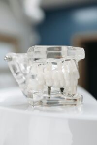Dental implant model for educational use
