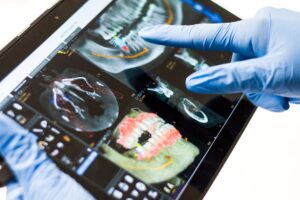 Dental X-ray analysis on tablet screen