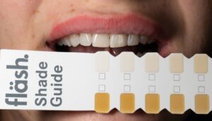 Teeth shade guide comparison with smiling mouth